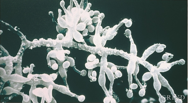 Electron Microscope Photo of cyclosporin mushroom Tolypocladium inflatum, magnified 500 times.